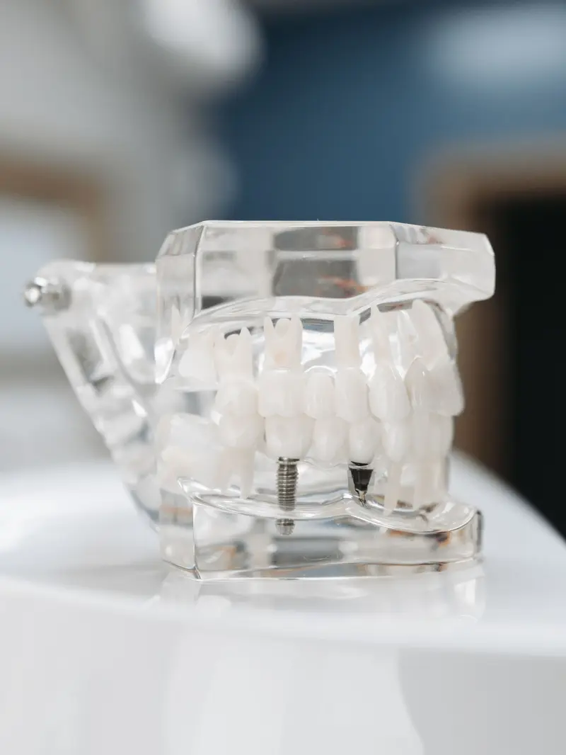 Advanced Implants